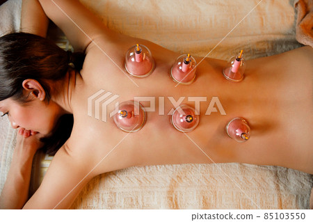 A young woman relaxes in a massage parlor. Vacuum cups of medical cupping therapy on woman back, close up, chinese medicine. 85103550