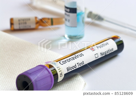 Blood sample tube with positive test for COVID-19 or novel coronavirus SARS-CoV-2. Blood sample tube with positive test for COVID-19 or novel coronavirus SARS-CoV-2. 85128609