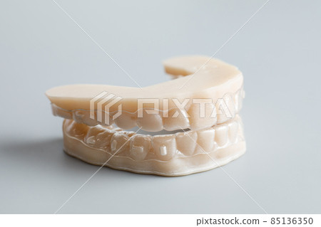 Individual silicone tooth tray for whitening. Teeth whitening concept. 85136350