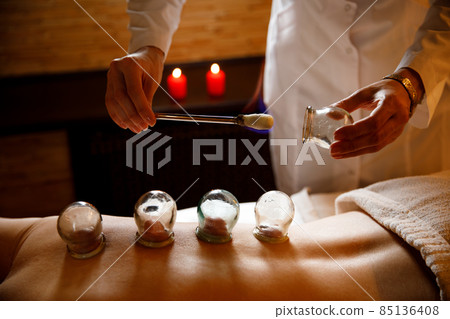 A young woman relaxes in a massage parlor. Vacuum cups of medical cupping therapy on woman back, close up, chinese medicine. A young woman relaxes in a massage parlor. Vacuum cups of medical cupping therapy on woman back, close up, chinese medicine. 85136408