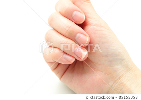 甲亢 85155358