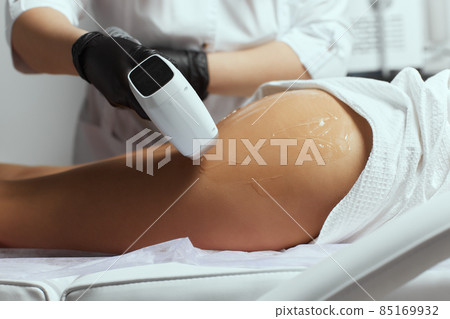 Young African woman getting laser hair removal on her thighs. Young African woman getting laser hair removal on her thighs. 85169932