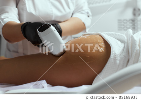 Young African woman getting laser hair removal on her thighs. 85169933