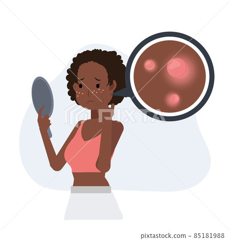 Acne concept.pimples. skin problems. African american woman is worried about her face getting acne. Flat vector cartoon character illustration. Acne concept.pimples. skin problems. African american woman is worried about her face getting acne. Flat vector cartoon character illustration. 85181988