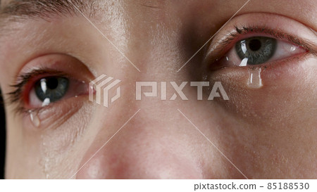 Close-up image of the woman's tearing eye 85188530