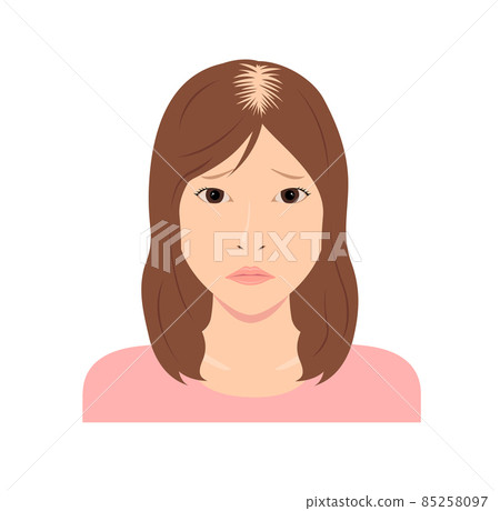Female diffuse alopecia vector illustration Female diffuse alopecia vector illustration 85258097