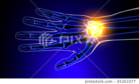 Wrist or Carpal joint pain Anatomy For Medical Concept 3D Wrist or Carpal joint pain Anatomy For Medical Concept 3D 85261077