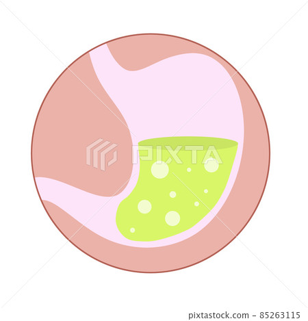Human stomach. Internal organ of body. 85263115