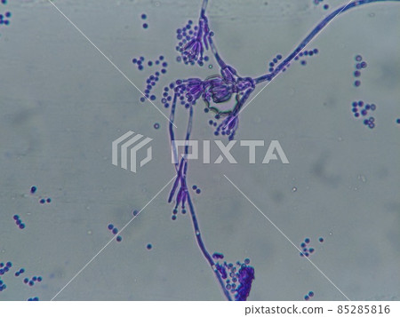 Micrograph of blue mold growing in the refrigerator Micrograph of blue mold growing in the refrigerator 85285816
