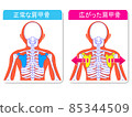 Normal scapula and widened scapula 85344509