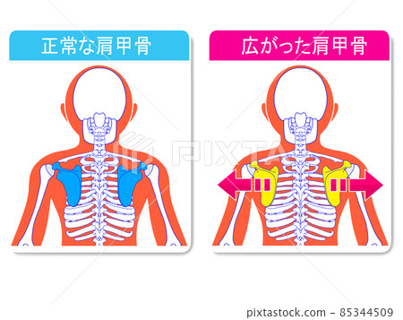 普通肩blade骨和加寬肩shoulder骨 普通肩blade骨和加寬肩shoulder骨 85344509