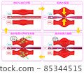 Comparison of blood circulation status 2 85344515