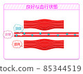 Good blood circulation 3 85344519