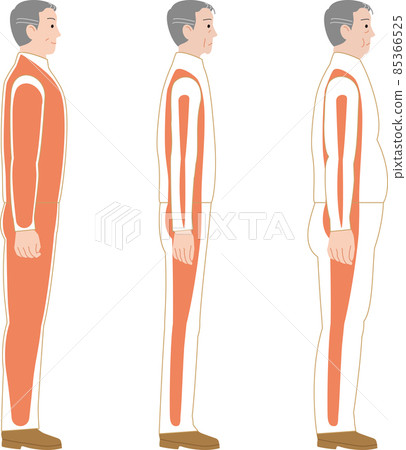 Image of muscle loss and sarcopenia obesity 85366525