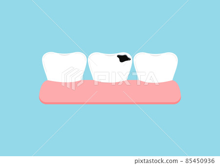 Tooth decay in gym dental icon isolated on blue background. 85450936