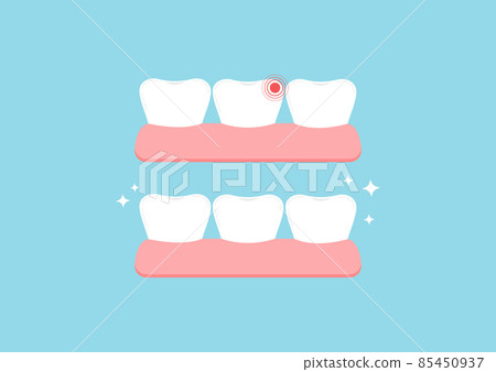 Tooth with ache pain vs healthy in gum isolated on blue background. Tooth with ache pain vs healthy in gum isolated on blue background. 85450937