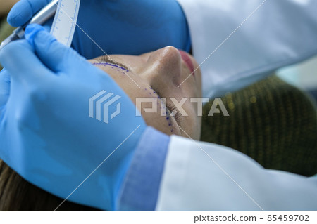 Marking before plastic surgery for eyebrow correction 85459702