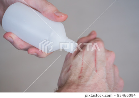 Man trying to treat cat scratches with cotton pad and hydrogen peroxide 85466094