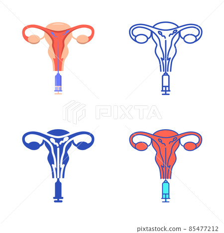 Intrauterine insemination icon set in flat and line style Intrauterine insemination icon set in flat and line style 85477212