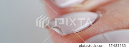 Broken female nails with manicure. Weak and brittle nails Broken female nails with manicure. Weak and brittle nails 85483283