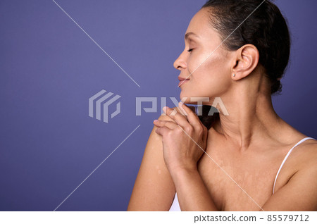 Confident closeup portrait. Delightful natural beauty woman with vitiligo dermatological skin problems smiling, hugging herself against purple background. Body positivity, self-acceptance. Copy space 85579712