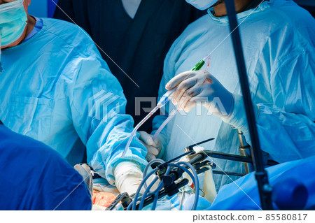 A catheter for suctioning blood in the surgeon's hand during surgery. 85580817