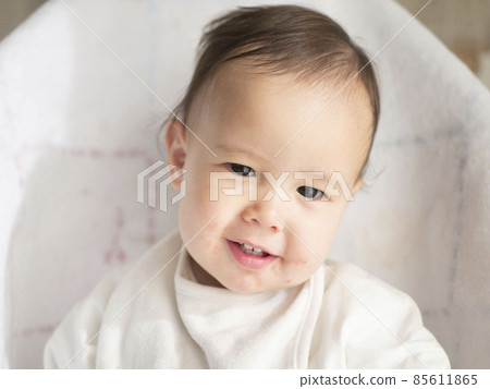 Image of eczema in the mouth of a half baby Image of eczema in the mouth of a half baby 85611865