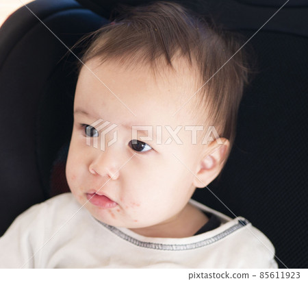Image of eczema in the mouth of a half baby 85611923