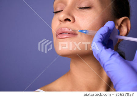 Dark-haired charming natural beauty woman with perfect clean healthy skin receiving beauty injection on her lips. Lips augmentation and correction concept. Aesthetic cosmetology and surgery. Close-up Dark-haired charming natural beauty woman with perfect clean healthy skin receiving beauty injection on her lips. Lips augmentation and correction concept. Aesthetic cosmetology and surgery. Close-up 85627057