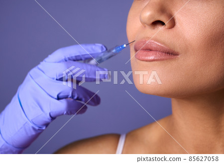 Injection cosmetology, aesthetic surgery, lips augmentation and correction concept. Close-up of woman face and hand in surgical glove holding syringe near her lips, ready to receive beauty treatment Injection cosmetology, aesthetic surgery, lips augmentation and correction concept. Close-up of woman face and hand in surgical glove holding syringe near her lips, ready to receive beauty treatment 85627058