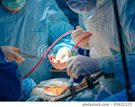 Bloody hands of doctors in sterile gloves. 85632125