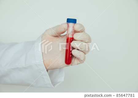 Hand holding a glass of test tube with patient's blood for testing 85647781