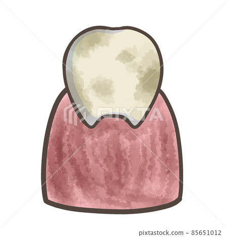 Dirty teeth and dirty gums Dirty teeth 85651012