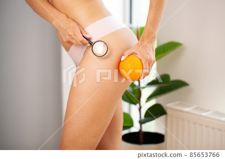 Cellulite problem concept, young woman holding orange near her leg 85653766