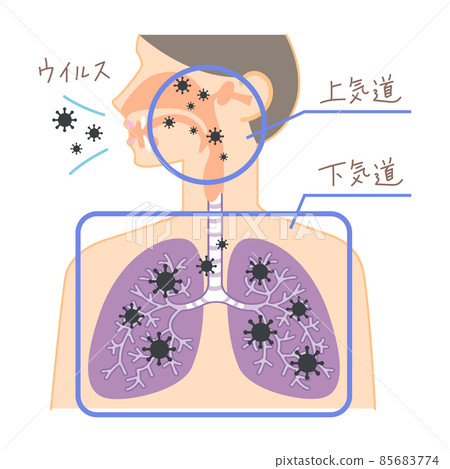 Invasion of the virus into the upper and lower respiratory tract (with illustrations and characters on the nose, throat, and lungs) 85683774