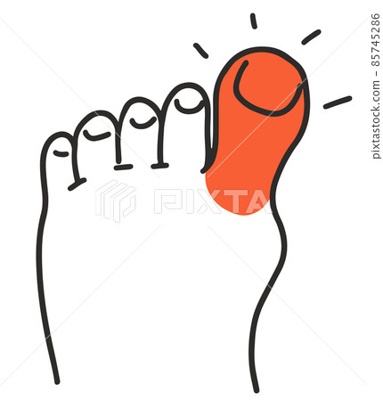 Pain and redness in big toe with gout 85745286
