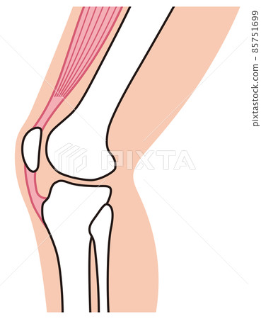 Knee joint explanatory diagram Sports injury Jumper knee Knee joint explanatory diagram Sports injury Jumper knee 85751699
