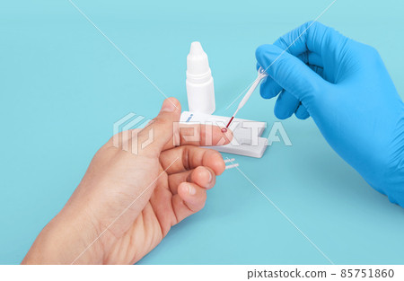 Doctor making Coronavirus COVID-19 quick Rapid Diagnostic Test RDT, Scientist worker place collected patient finger prick blood sample specimen on cassette, COVID-19 antigen rapid test concept 85751860