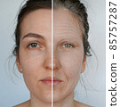 Comparison. Portrait of a beautiful woman before and after the disease. Youth, old age. Process of aging and rejuvenation 85757287