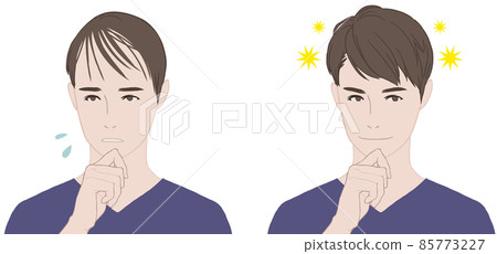 頭髮稀疏的男人和頭髮蓬鬆的男人 85773227