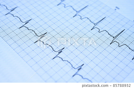 electro-cardiogram 85788932