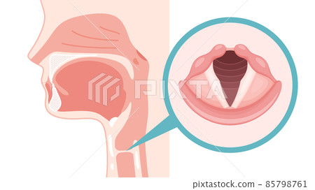 Illustration of vocal cords_Position in sagittal section_Real 85798761
