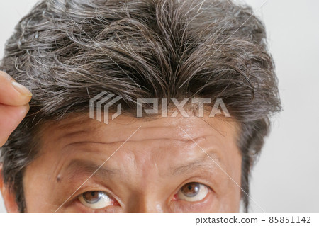 Middle-aged men who are worried about their hair 85851142