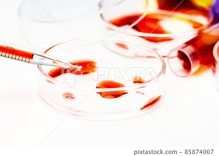 Petri dish and test tubes with blood in the laboratory. Blood coronavirus test.Virus vaccine development.Medical laboratory. The concept of laboratory research. Close-up.COVID-19. Corona Virus in Lab. Petri dish and test tubes with blood in the laboratory. Blood coronavirus test.Virus vaccine development.Medical laboratory. The concept of laboratory research. Close-up.COVID-19. Corona Virus in Lab. 85874007