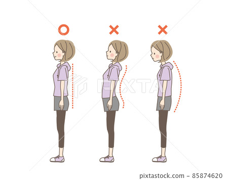 Female set with stoop, warped hips and straight posture 85874620