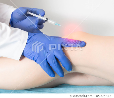 Modern knee injection to restore joint mobility and relieve inflammation and pain, close-up. Lateral gonarthrosis Modern knee injection to restore joint mobility and relieve inflammation and pain, close-up. Lateral gonarthrosis 85905872