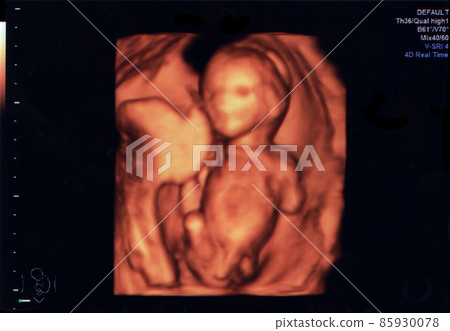 3D echo photography 85930078
