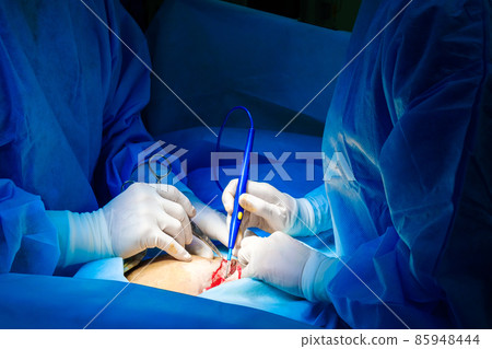 Selective focus on the hands of doctors wearing white sterile gloves. Selective focus on the hands of doctors wearing white sterile gloves. 85948444