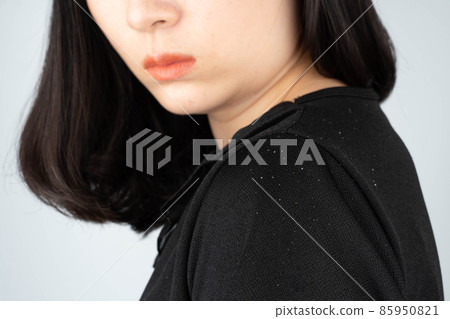 Dandruff and seborrheic dermatitis problem. Long black hair woman looking at hair flakes on her shoulder. Hair care concept. Selective focus. 85950821