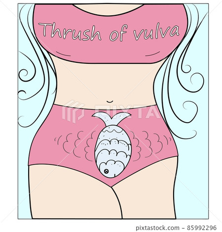 Vaginal thrush, candidiasis. Vaginal infection. Funny cartoon style illustration Vaginal thrush, candidiasis. Vaginal infection. Funny cartoon style illustration 85992296